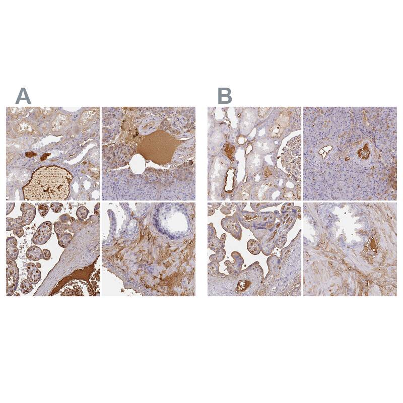 <b>Orthogonal Strategies Validation. </b>Staining of human kidney, pancreas, placenta and prostate HPA031024 (A) shows similar protein distribution across tissues to independent antibody HPA031025 (B).