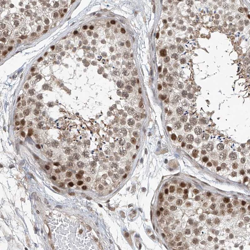 Immunohistochemistry-Paraffin TAF8 Antibody - BSA Free
