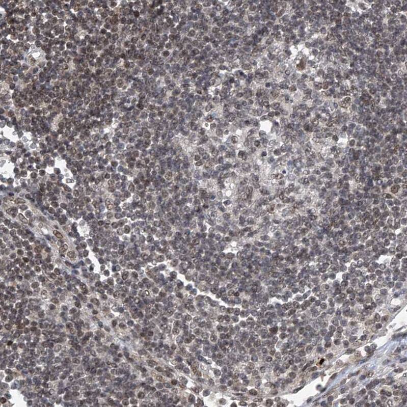 Staining of human lymph node shows weak nuclear positivity in non-germinal center cells.