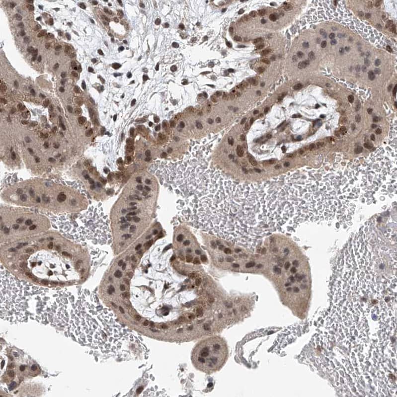 Staining of human placenta shows moderate nuclear positivity in trophoblastic cells.