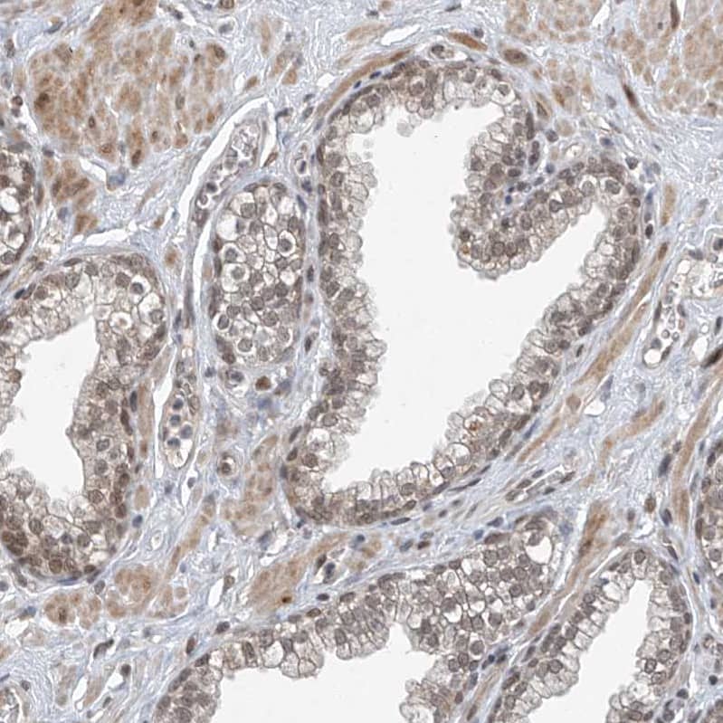 Staining of human prostate shows weak to moderate nuclear positivity in glandular cells.