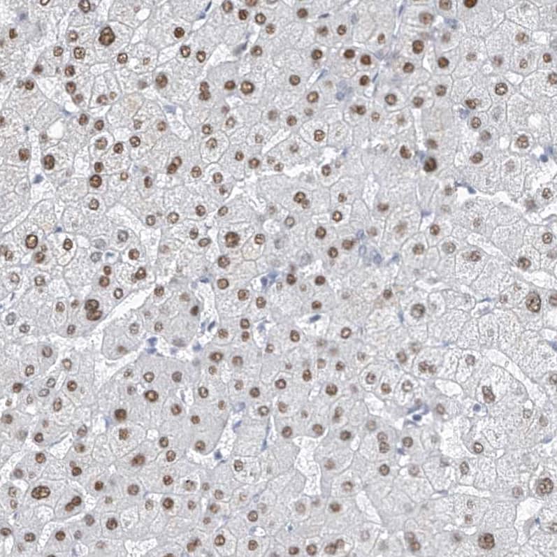 Staining of human liver shows moderate nuclear positivity in hepatocytes.