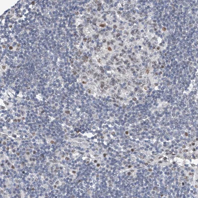 Staining of human lymph node shows moderate nuclear positivity in germinal center cells.