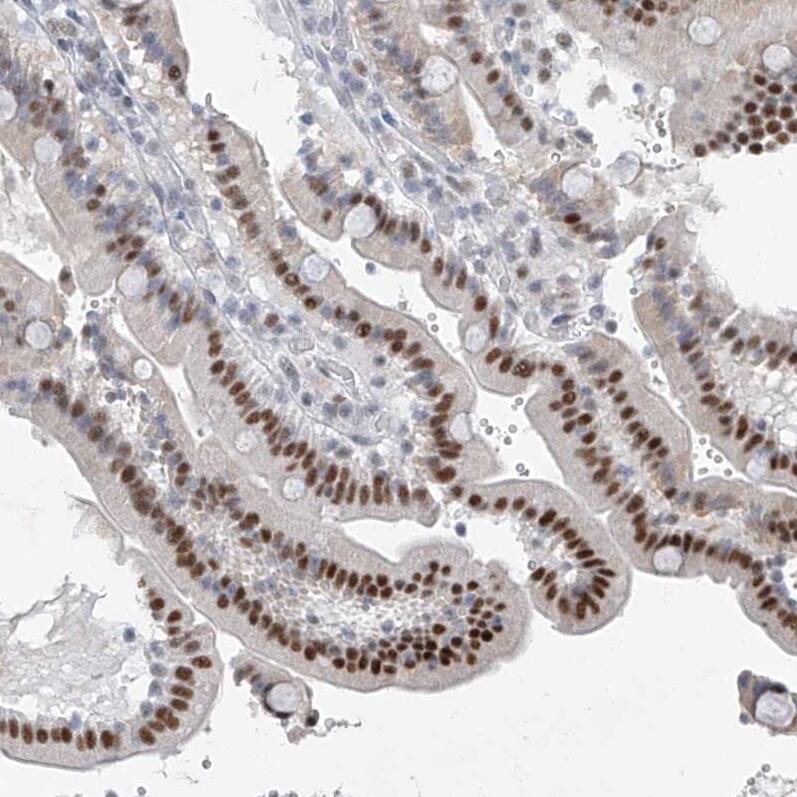 Staining of human duodenum shows moderate nuclear positivity in glandular cells.