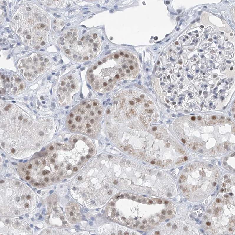 Staining of human kidney shows moderate nuclear positivity in cells in tubules.