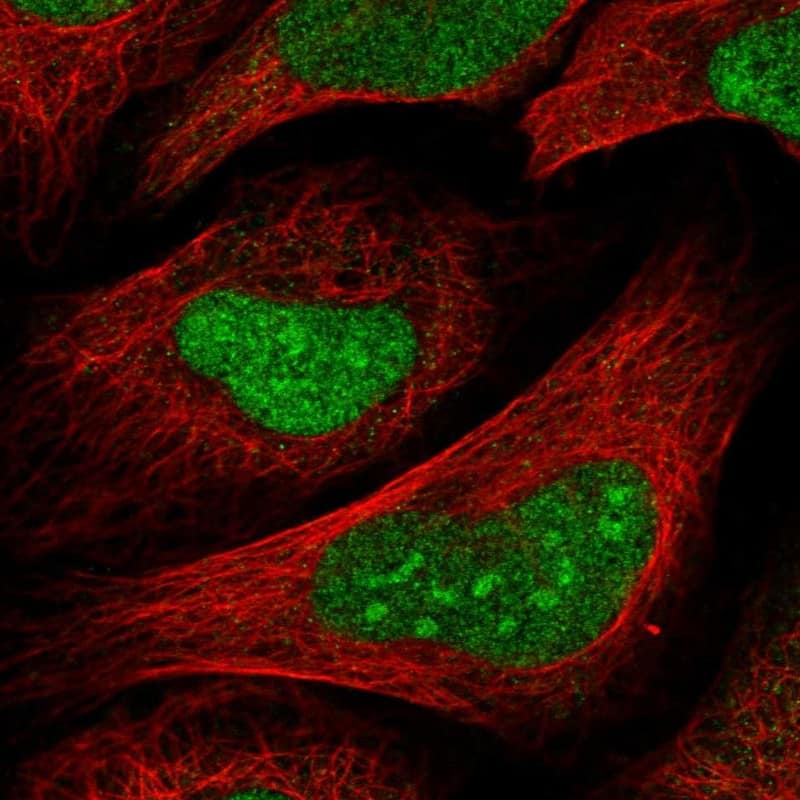 Immunocytochemistry/ Immunofluorescence TSPYL1 Antibody - BSA Free