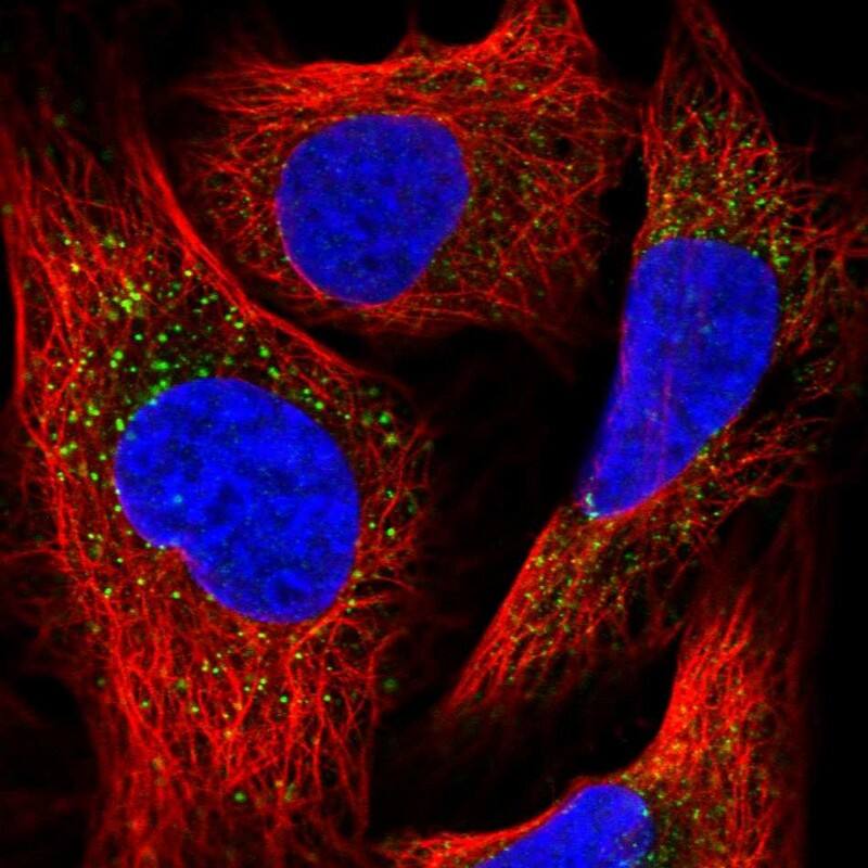 Staining of human cell line U-2 OS shows localization to vesicles.