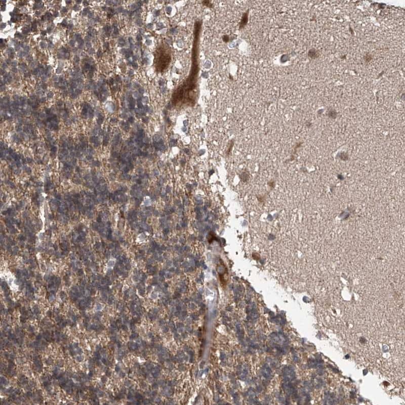 Staining of human cerebellum shows distinct cytoplasmic positivity in Purkinje cells.