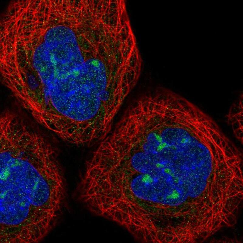 Staining of human cell line A-431 shows localization to nucleoli.