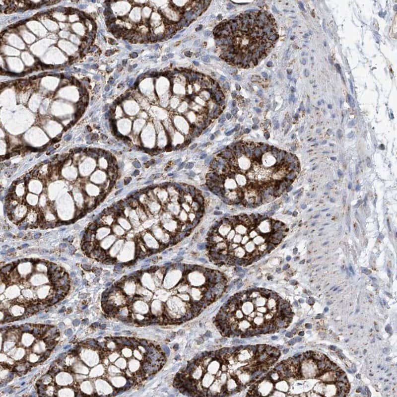 <b>Independent Antibodies Validation. </b>Staining of human rectum shows strong cytoplasmic positivity with a granular pattern in glandular cells.