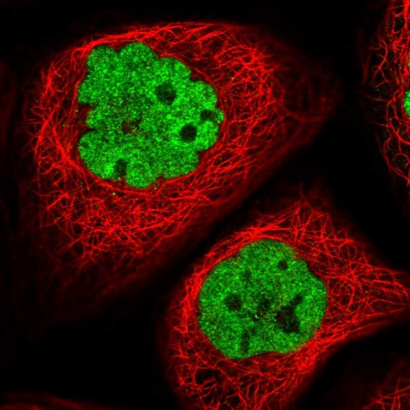 Staining of human cell line A-431 shows localization to nucleoplasm.
