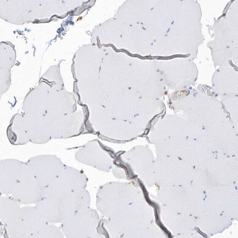 Staining of human skeletal muscle shows no positivity in myocytes as expected.