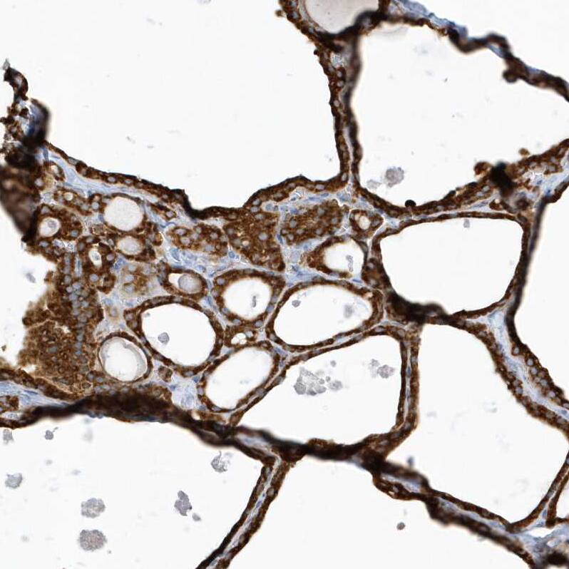 Staining of human thyroid gland shows strong cytoplasmic positivity in glandular cells.