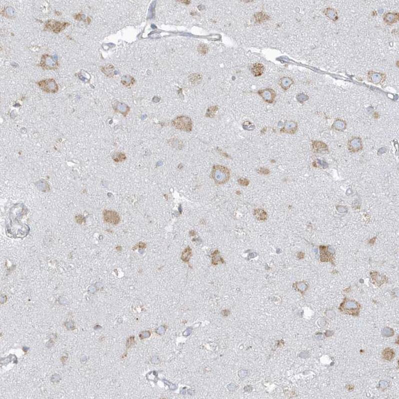 Staining of human cerebral cortex shows moderate granular cytoplasmic positivity in neurons.