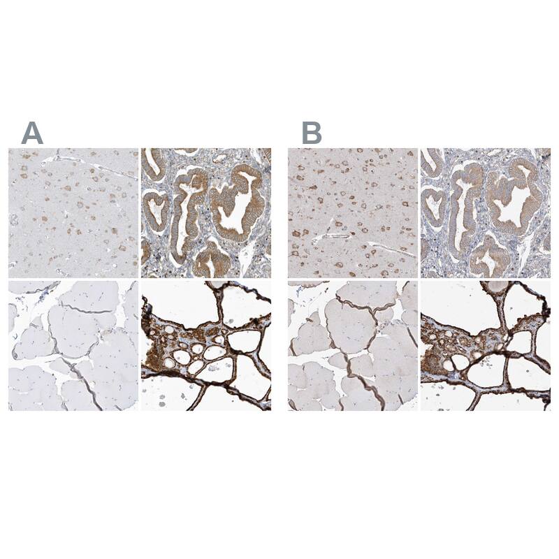 <b>Orthogonal Strategies Validation. </b>Staining of human cerebral cortex, endometrium, skeletal muscle and thyroid gland HPA034652 (A) shows similar protein distribution across tissues to independent antibody HPA034653 (B).