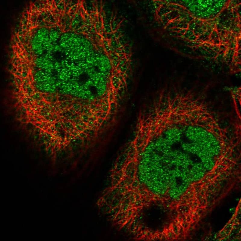 Staining of human cell line A-431 shows localization to nucleoplasm.