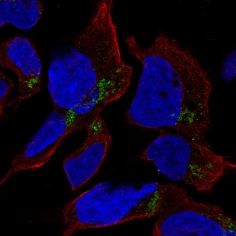 Staining of human cell line AF22 shows localization to the Golgi apparatus.