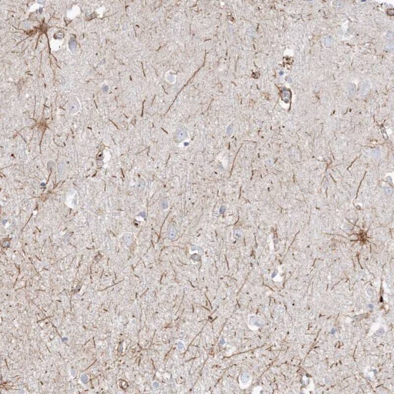 Staining of human cerebral cortex shows positivity in neuronal processes.