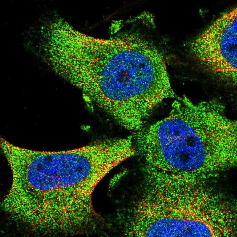 Staining of human cell line U-251 MG shows localization to cytosol.