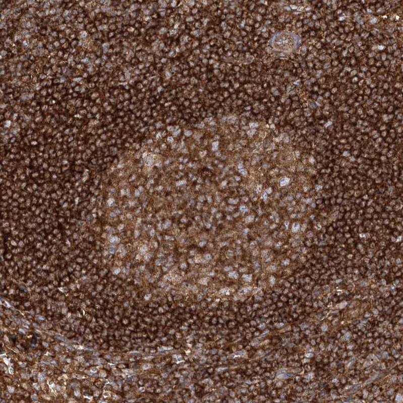 Staining of human lymph node shows strong positivity in lymphocytes.