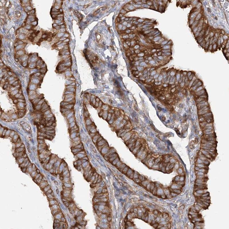 Staining of human fallopian tube shows strong positivity in glandular cells.