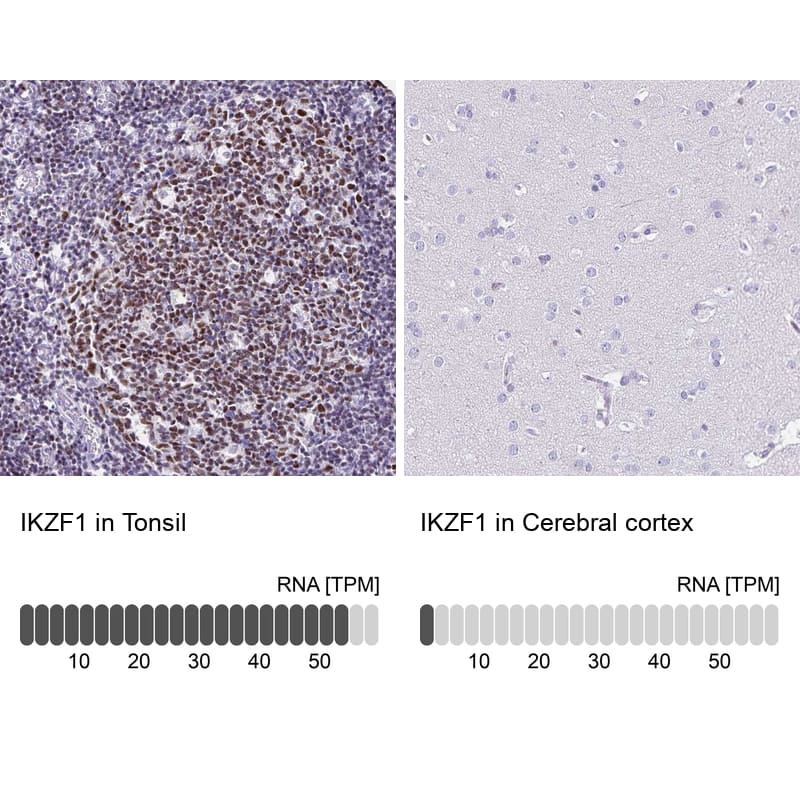 <b>Orthogonal Strategies Validation. </b>Analysis in human tonsil and cerebral cortex tissues. Corresponding RNA-seq data are presented for the same tissues.