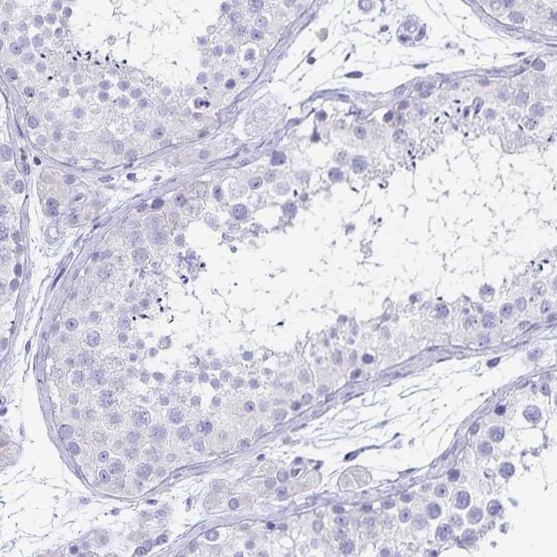 Staining of human testis shows no positivity in cells in seminiferous ducts as expected.