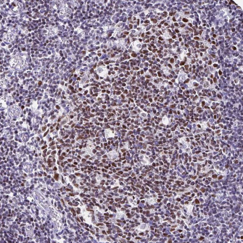 Staining of human tonsil shows strong nuclear positivity in germinal center cells.