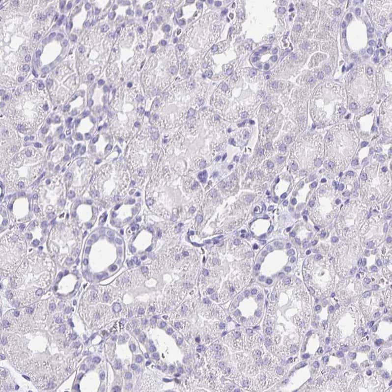 Staining of human kidney shows no positivity in cells in tubules as expected.