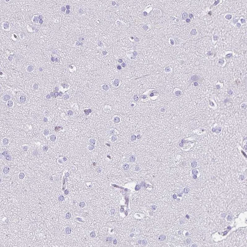 Staining of human cerebral cortex shows no positivity in neurons as expected.