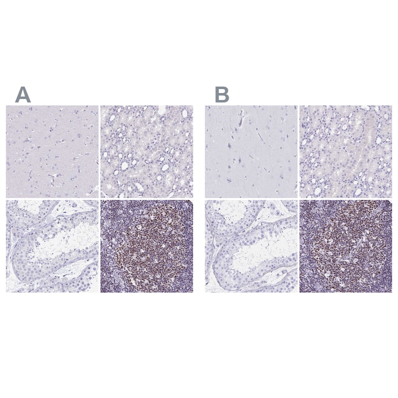 <b>Orthogonal Strategies Validation. </b>Staining of human cerebral cortex, kidney, testis and tonsil HPA035221 (A) shows similar protein distribution across tissues to independent antibody HPA035222 (B).