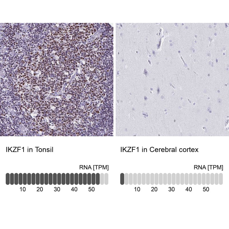 <b>Orthogonal Strategies Validation. </b>Analysis in human tonsil and cerebral cortex tissues. Corresponding RNA-seq data are presented for the same tissues.