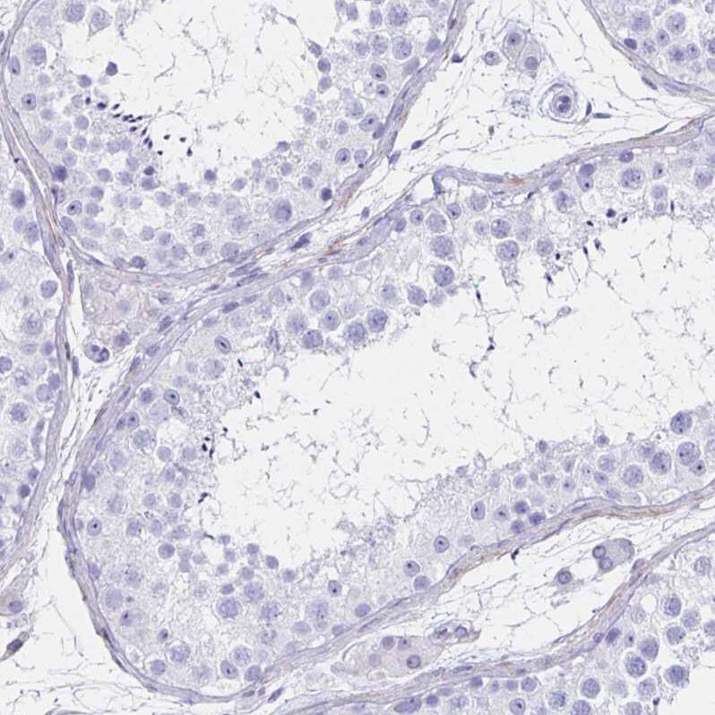 Staining of human testis shows no positivity in cells in seminiferous ducts as expected.
