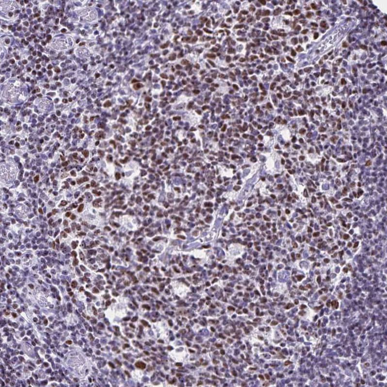 Staining of human tonsil shows strong nuclear positivity in germinal center cells.