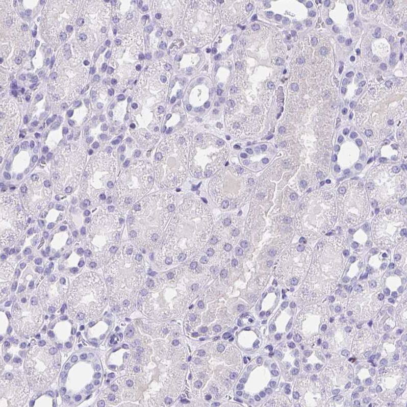 Staining of human kidney shows no positivity in cells in tubules as expected.