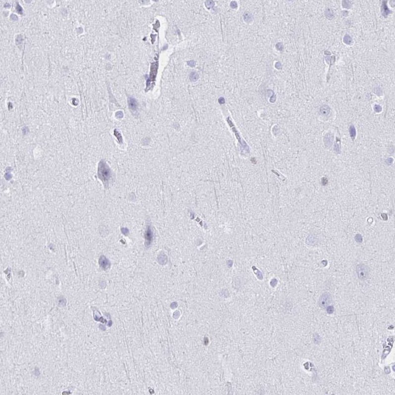 Staining of human cerebral cortex shows no positivity in neurons as expected.