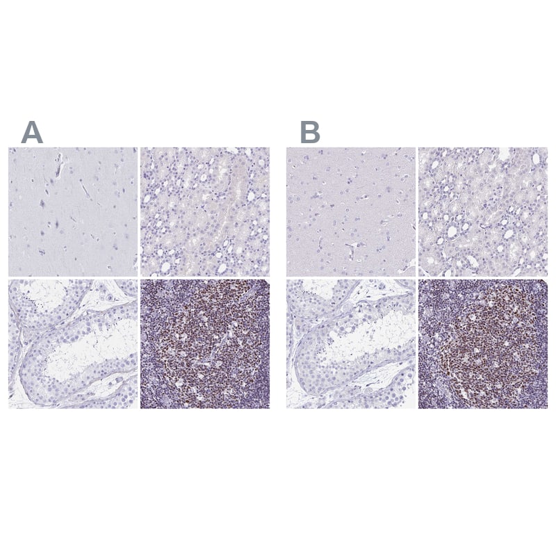 <b>Orthogonal Strategies Validation. </b>Staining of human cerebral cortex, kidney, testis and tonsil HPA035222 (A) shows similar protein distribution across tissues to independent antibody HPA035221 (B).