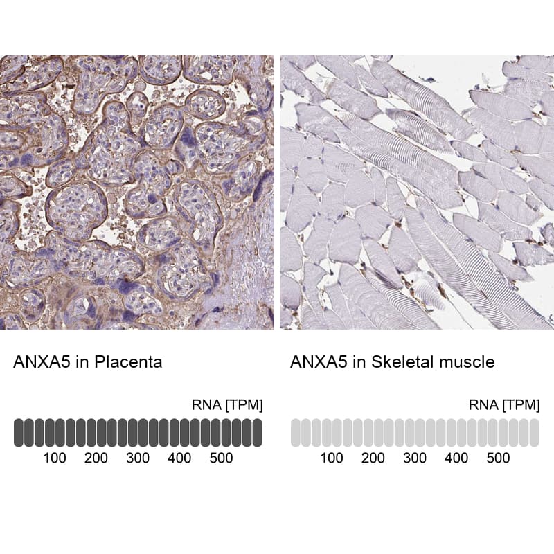 <b>Orthogonal Strategies Validation. </b>Analysis in human placenta and skeletal muscle tissues. Corresponding RNA-seq data are presented for the same tissues.