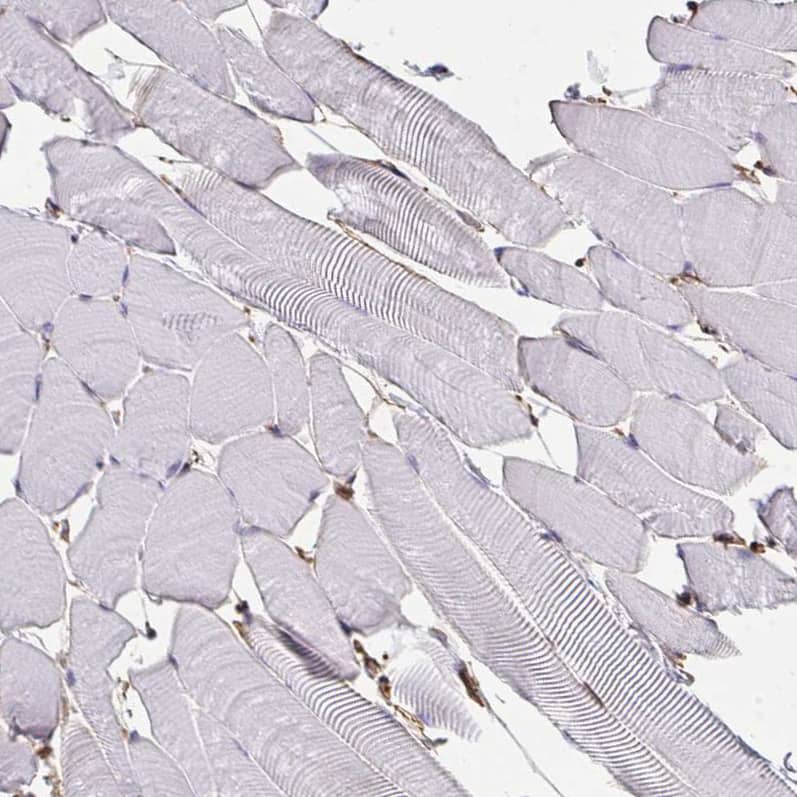 Staining of human skeletal muscle shows low positivity in myocytes as expected.