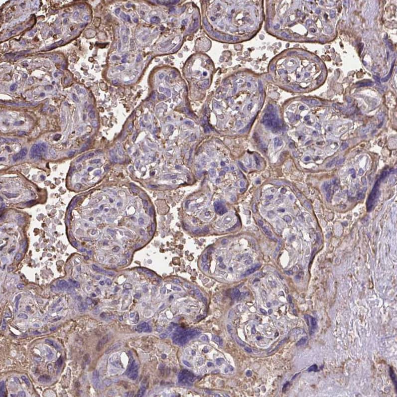 Staining of human placenta shows moderate  membranous positivity in trophoblastic cells.