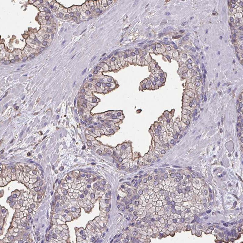 Staining of human prostate shows moderate  membranous positivity in glandular cells.
