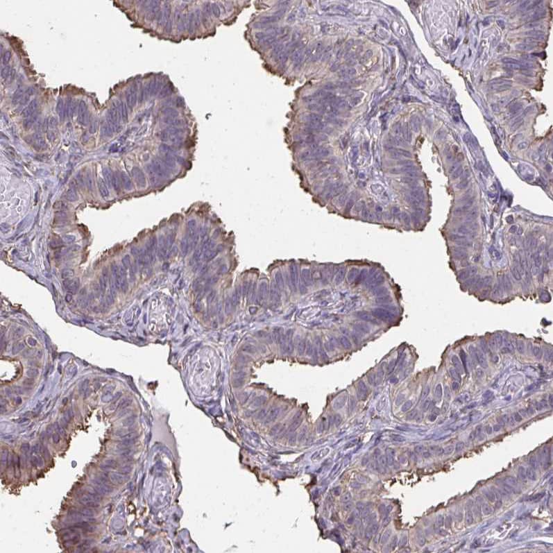 Staining of human fallopian tube shows moderate positivity in cilia in glandular cells.
