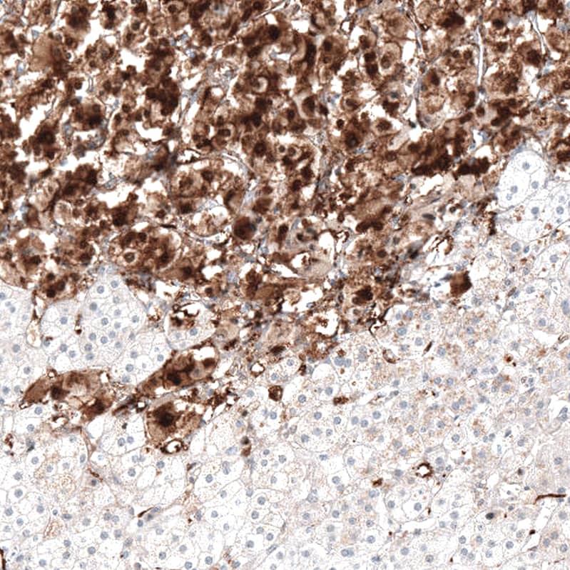 Staining of human adrenal gland shows strong cytoplasmic positivity in glandular cells.