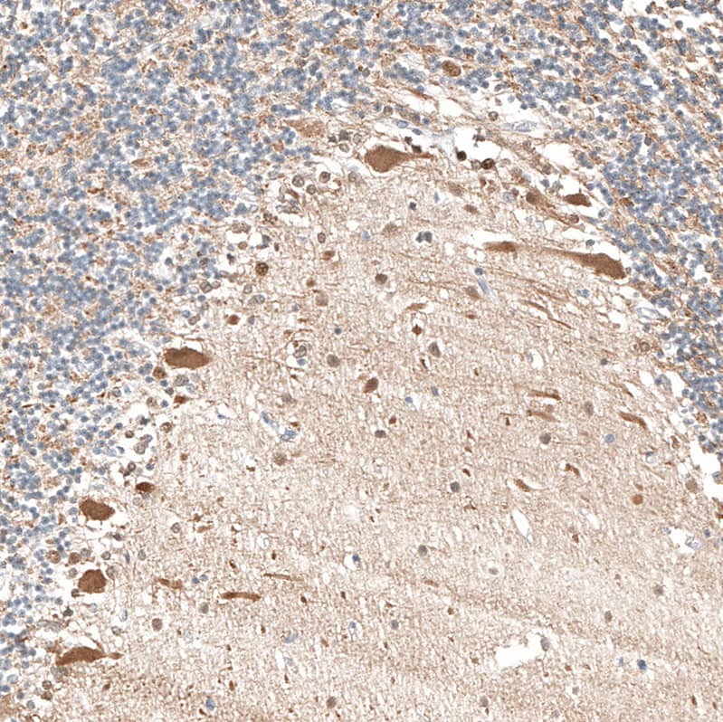 Staining of human cerebellum shows strong cytoplasmic positivity in Purkinje cells.
