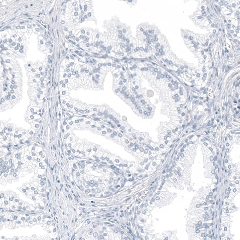 Staining of human prostate shows no positivity in glandular cells as expected.