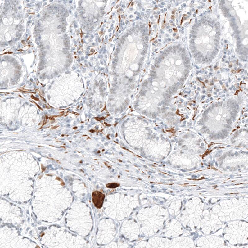 Staining of human small intestine shows strong cytoplasmic positivity in peripheral nerve / ganglion.