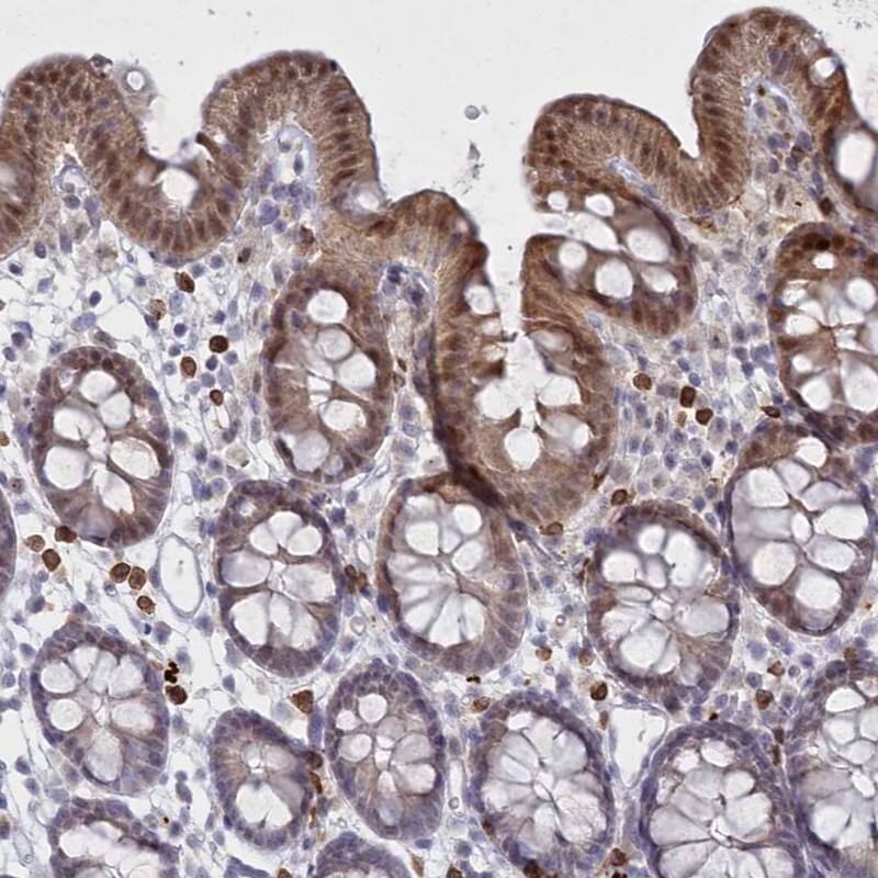 Staining of human colon shows moderate cytoplasmic and nuclear positivity in glandular cells.