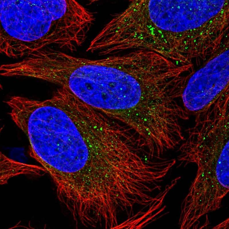 Staining of human cell line U-2 OS shows localization to vesicles.