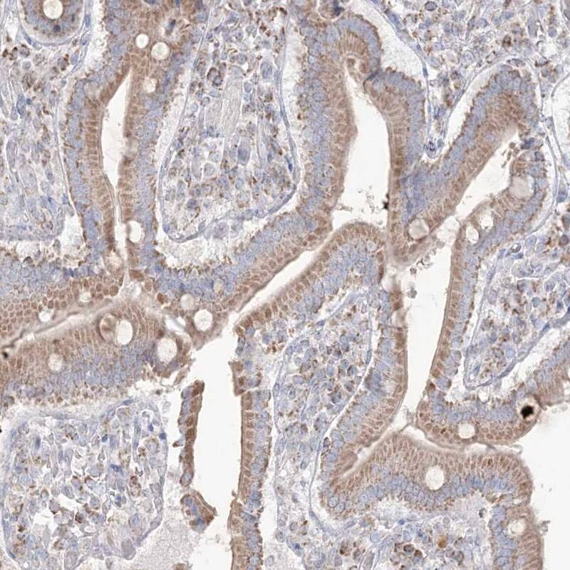 Immunohistochemistry-Paraffin KCTD6 Antibody - BSA Free