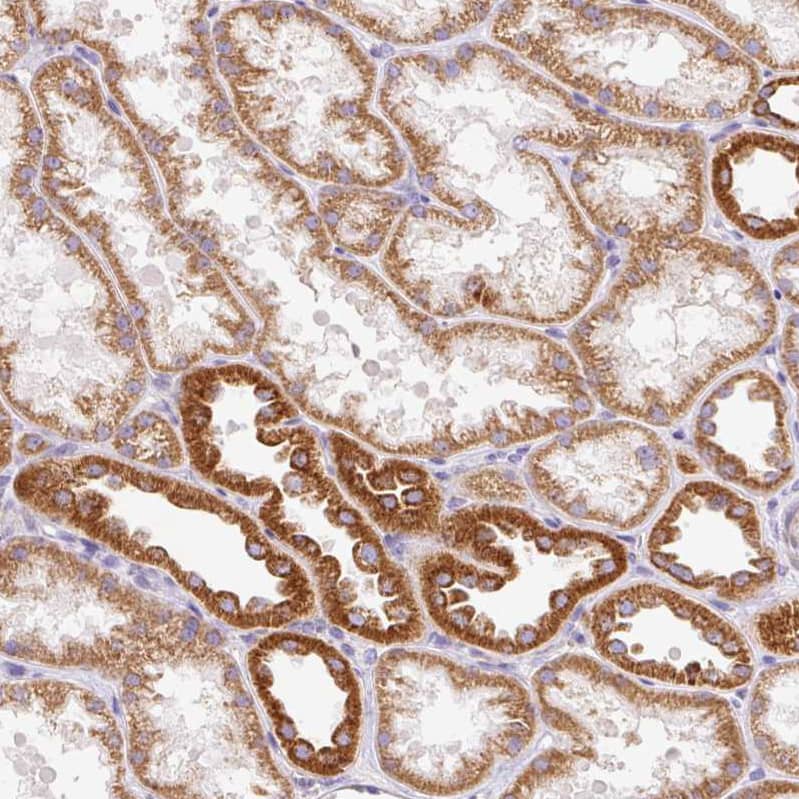 Staining of human kidney shows strong granular cytoplasmic positivity in cells in tubules.